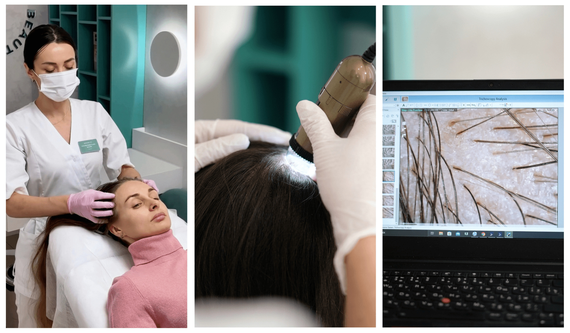 prijom-trihologa-na-livomu-berezi-kiyeva-nemyrovska-beauty-clinic Прийом у трихолога на Лівому березі Києва
